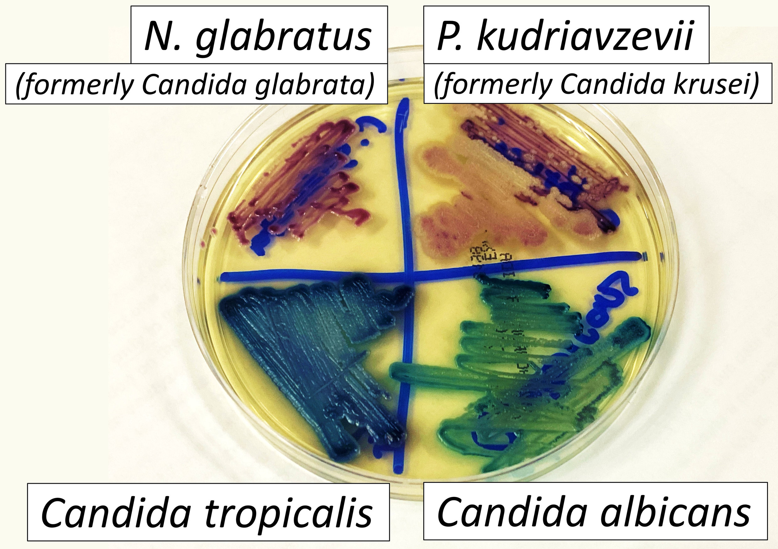 CHROMagar Candida contoh warna koloni