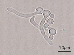Germ tube test (contoh)